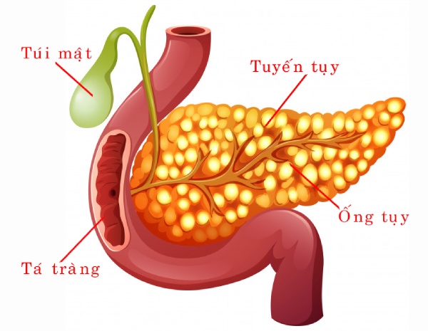 Cấy ghép tuyến tụy là một phương pháp được áp dụng để điều trị tiểu đường tuýp 1