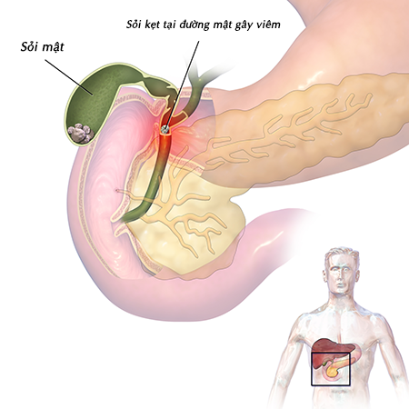 Sữa tiểu đường Gluzabet