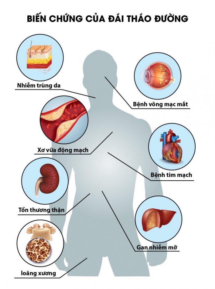 Sữa tiểu đường Gluzabet