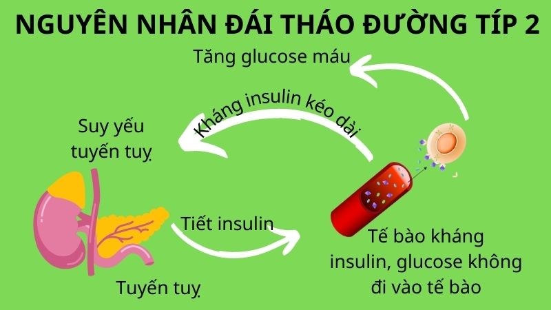 Sự thiếu hụt Insulin là nguyên nhân chính của tiểu đường tuýp 2