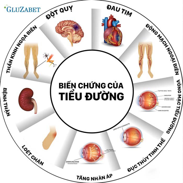 Biến chứng của tiểu đường rất nhiều và rất nguy hiểm