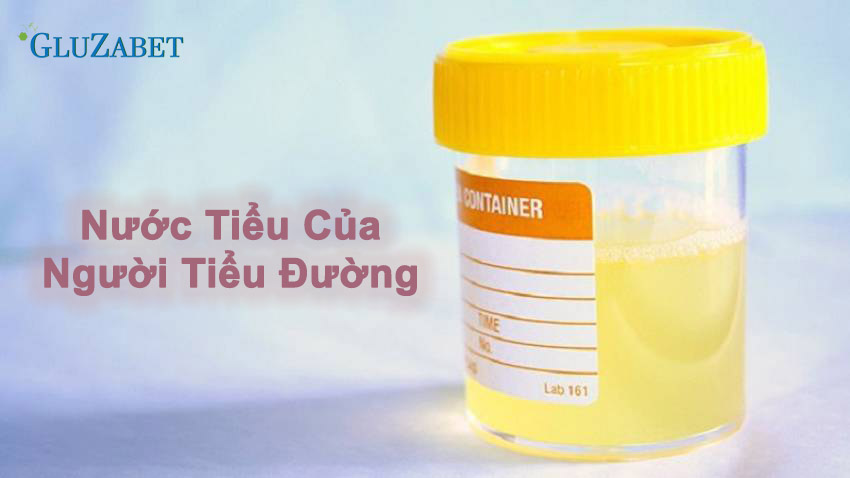 Nước tiểu của người bị tiểu đường